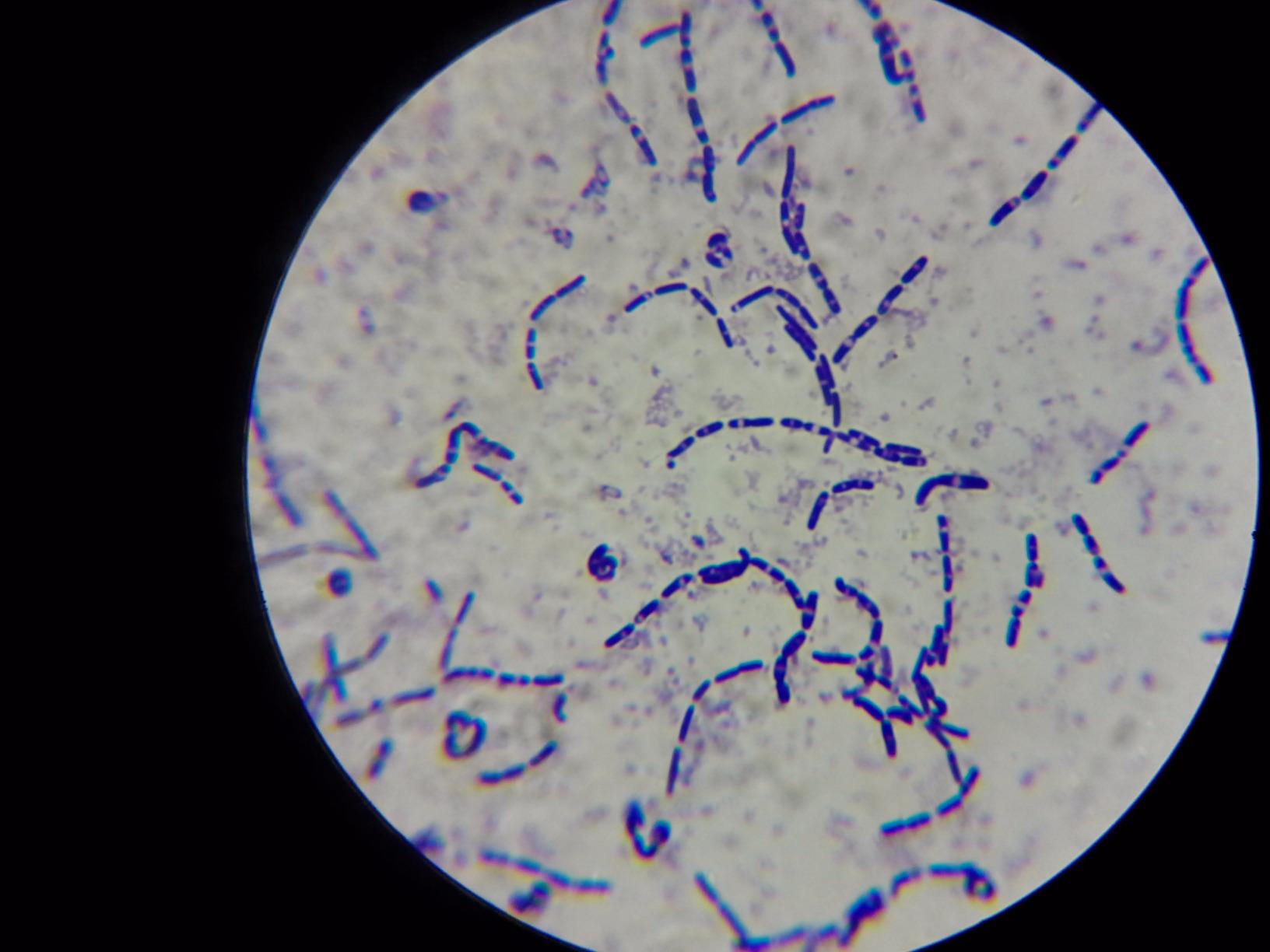 OMAX M82ES-SC100-LP100-OM 2000X LED Binocular Compound Lab Microscope customer photo 1