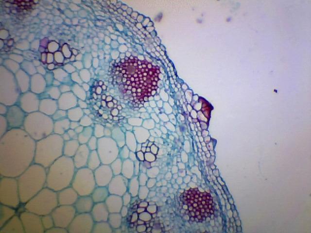 AmScope B120C-E1 LED Binocular Compound Microscope, 40X-2500X customer photo 1