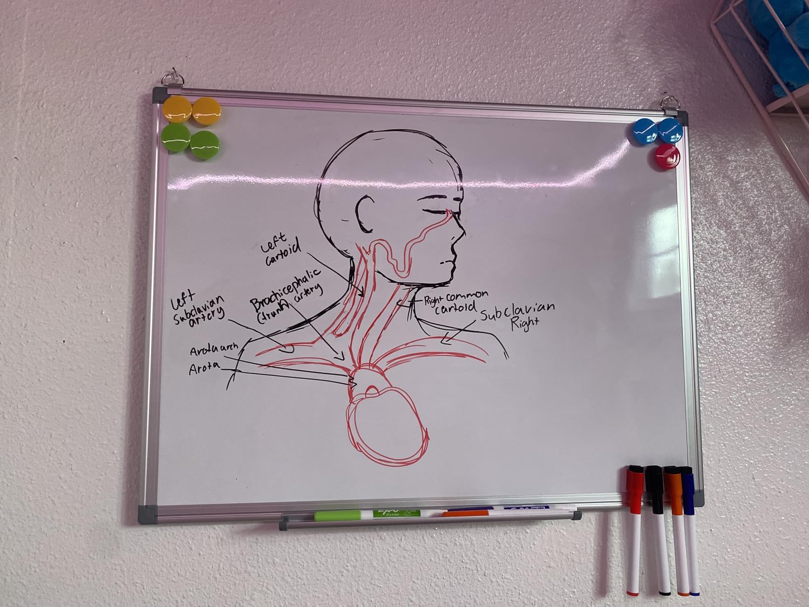 Double-Sided White Board Dry Erase Magnetic Whiteboard Wall 24x18 Silver customer photo 2