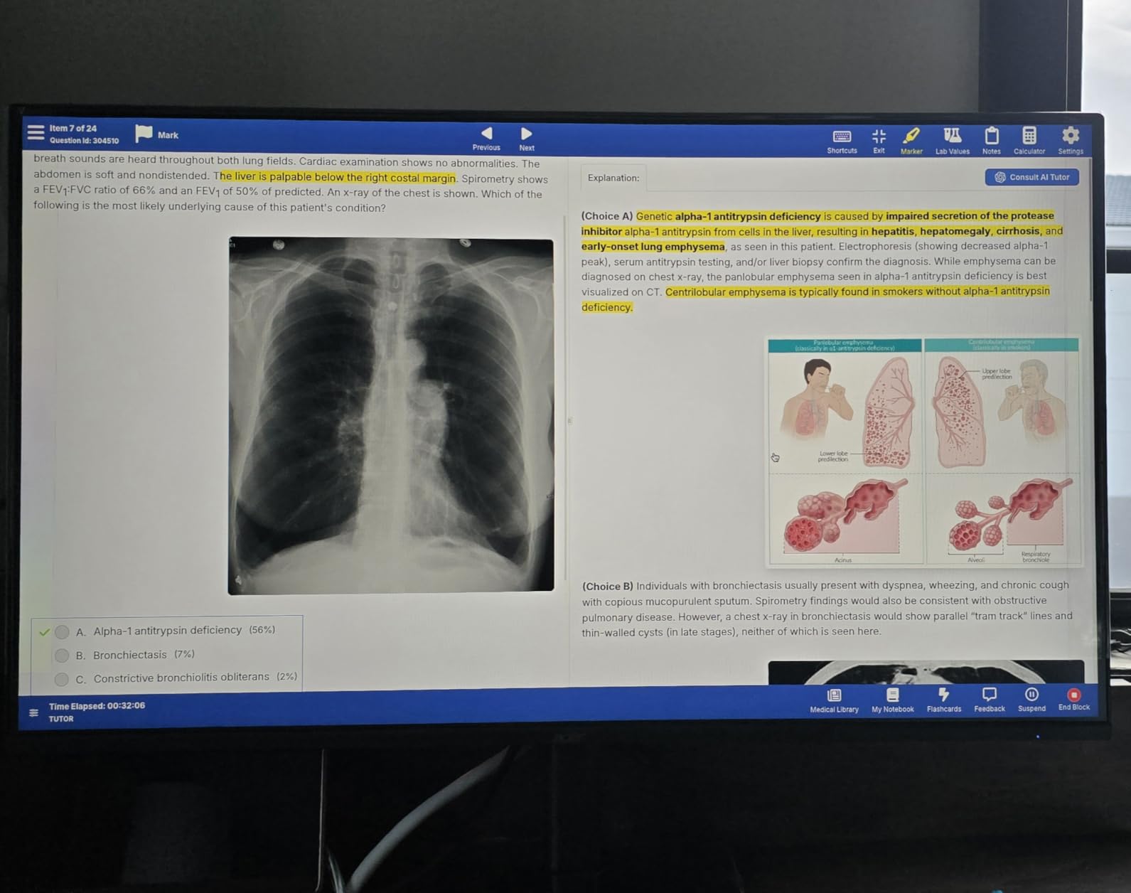 Acer 27in FHD 1920x1080 IPS 120Hz Gaming Monitor | Office KB272 G0bi customer photo 1