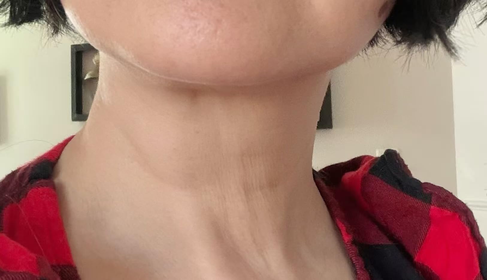 7-in-1 Microcurrent Facial Device, Gua Sha Red Light Face & Neck Massager customer photo 2