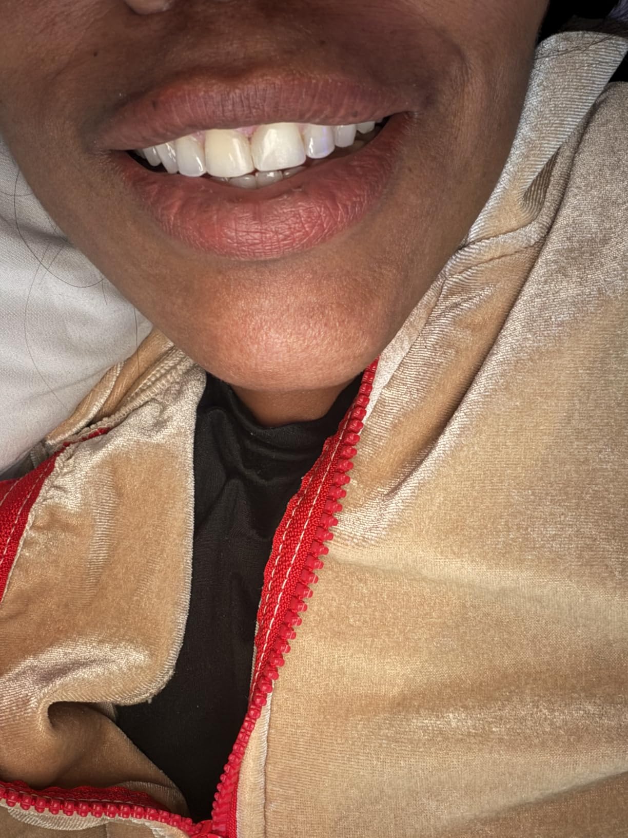GuruNanda Teeth Whitening Kit, Up to 10 Shades Whitening, 40 Treatments customer photo 2